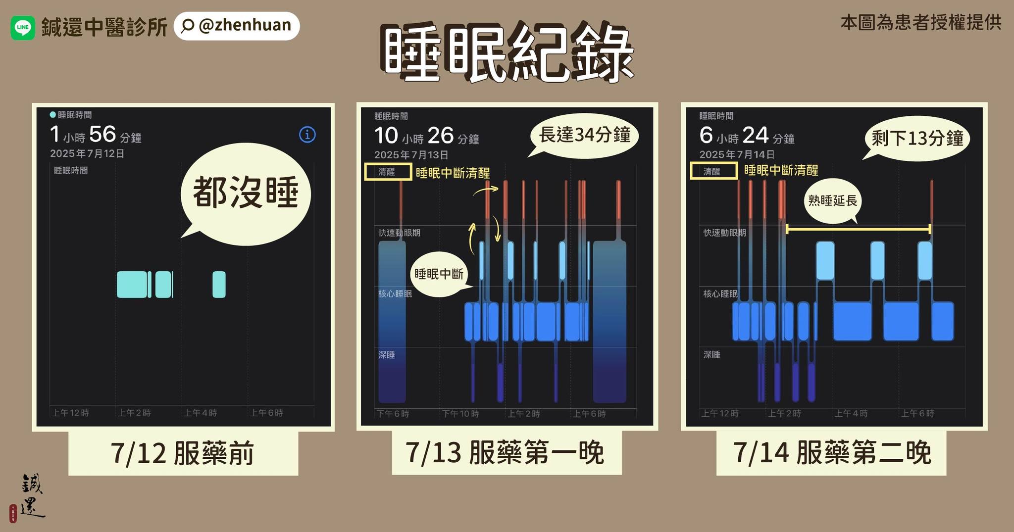 舌頭灼熱、手掌疼痛與整夜失眠的中醫睡眠追蹤數據，蕭家駒醫師說明