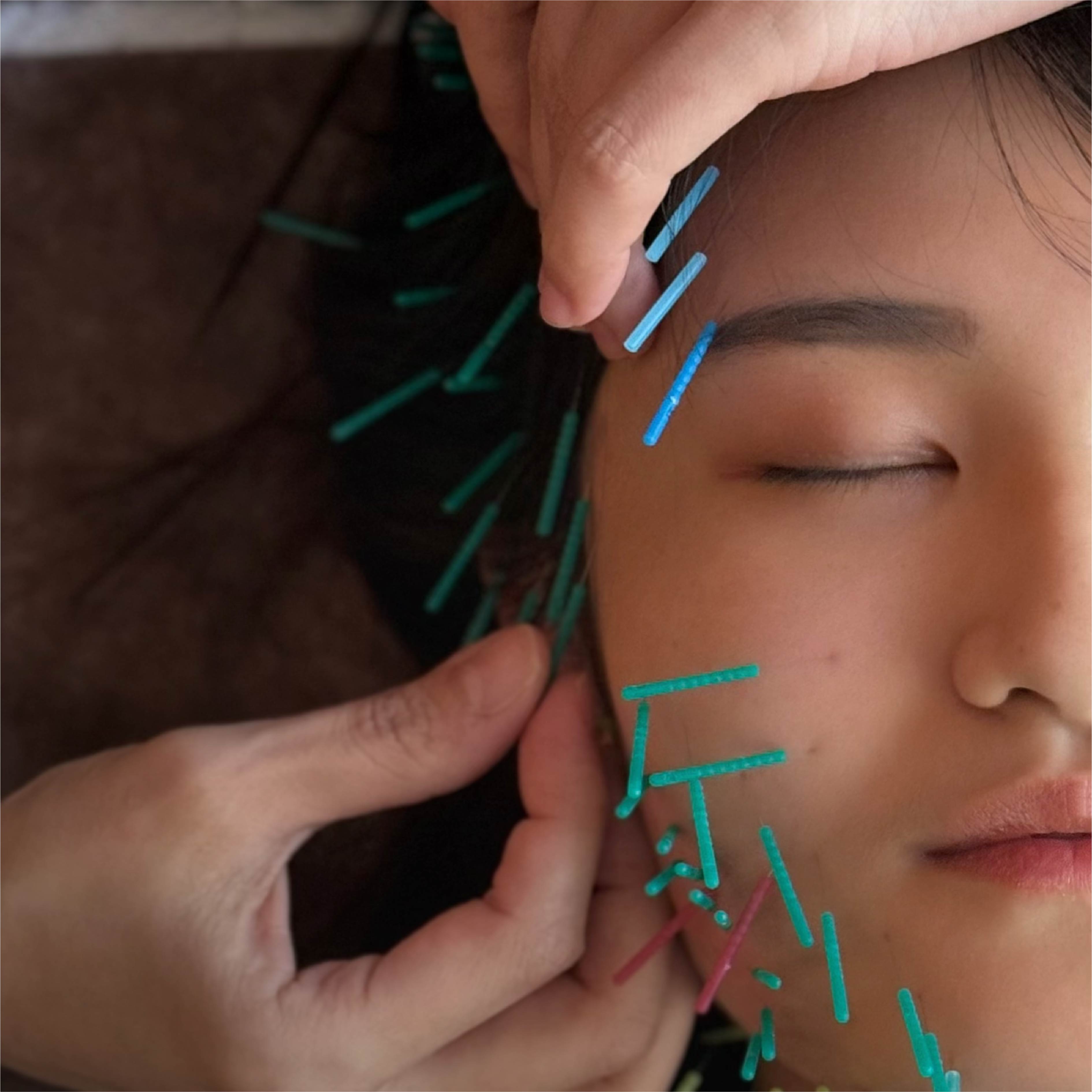 肌賦能美顏鍼