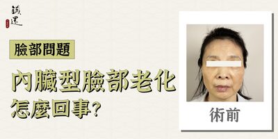內臟型臉部老化怎麼回事？