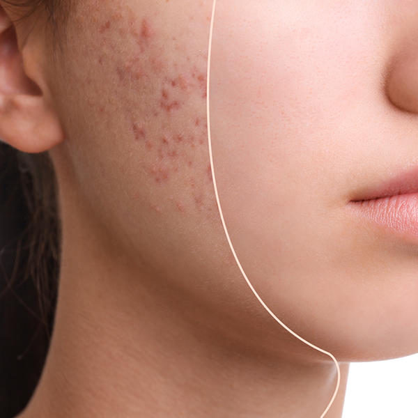 Enhancing Skin Condition