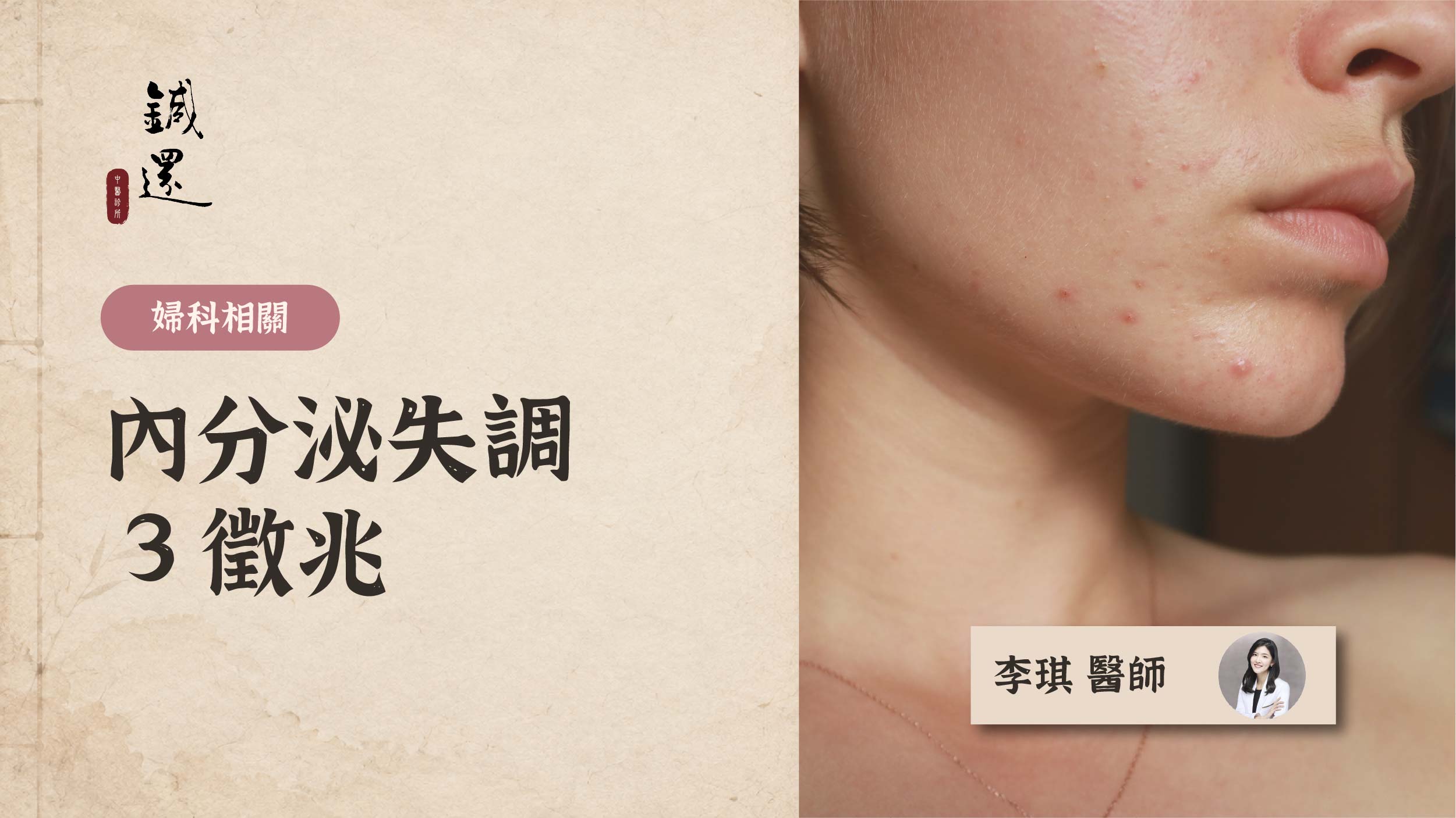 hormonal-imbalance-symptoms-tcm